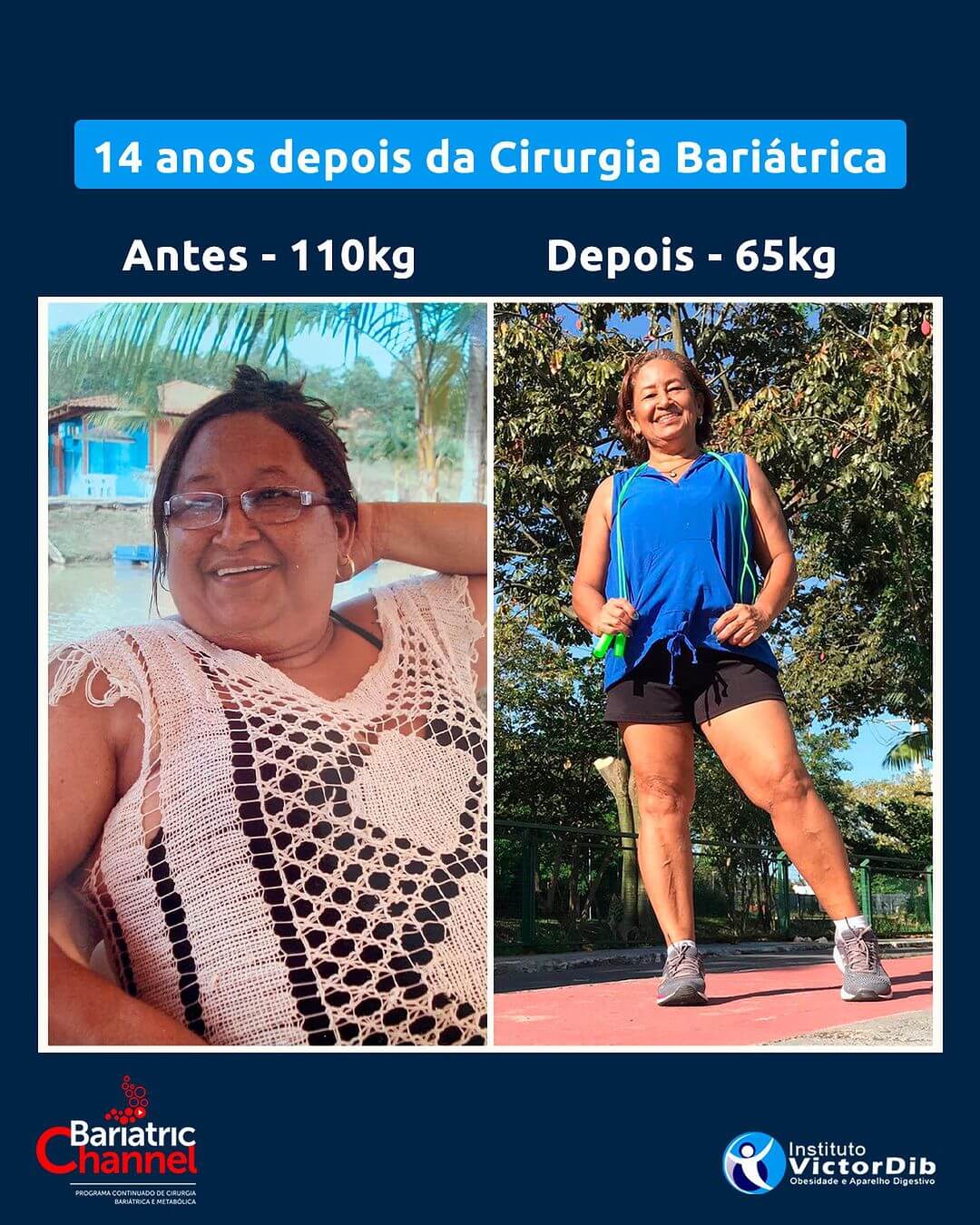 Antes e Depois 3.1T