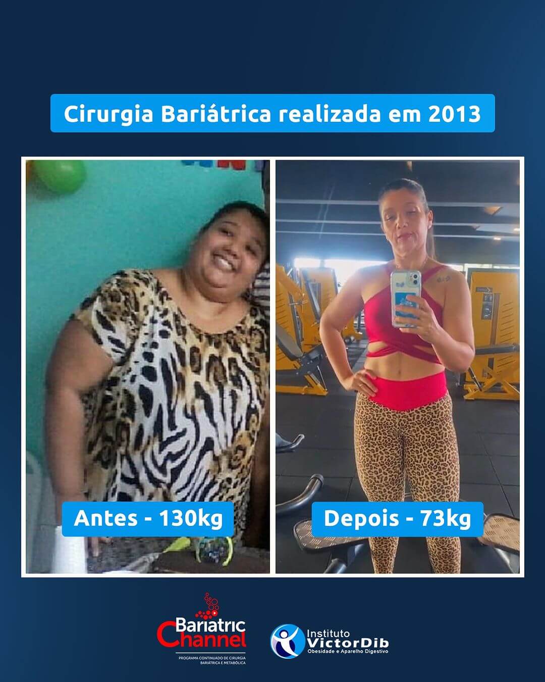 Antes e Depois 5T