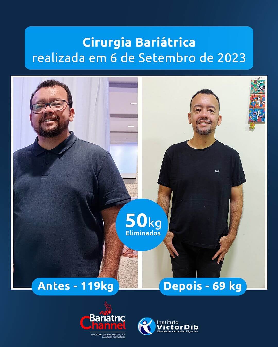 Antes e Depois 6T