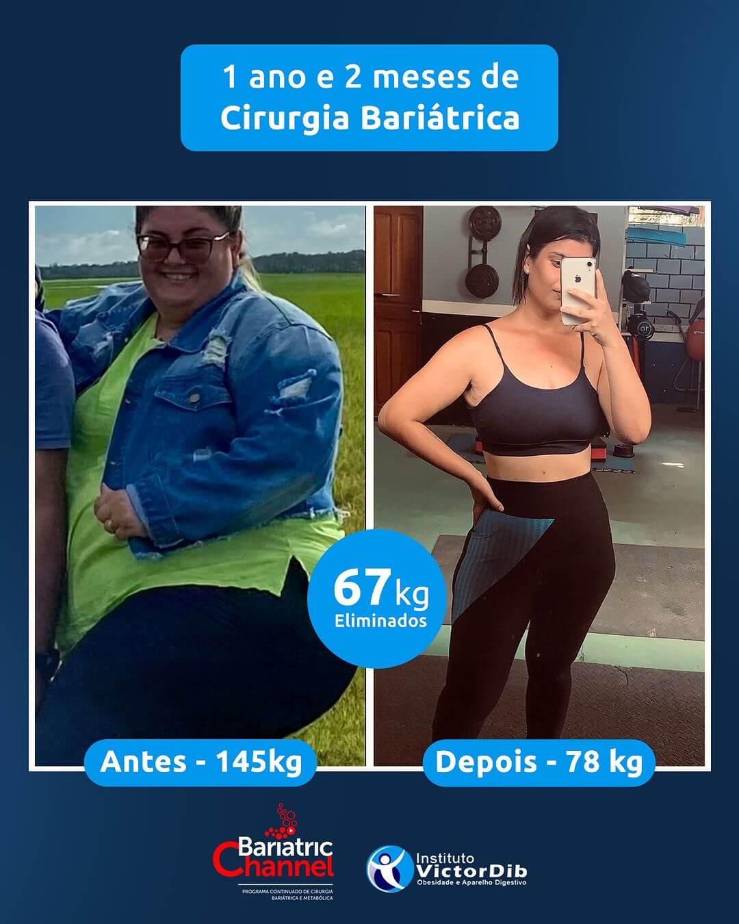 Antes e Depois 8T